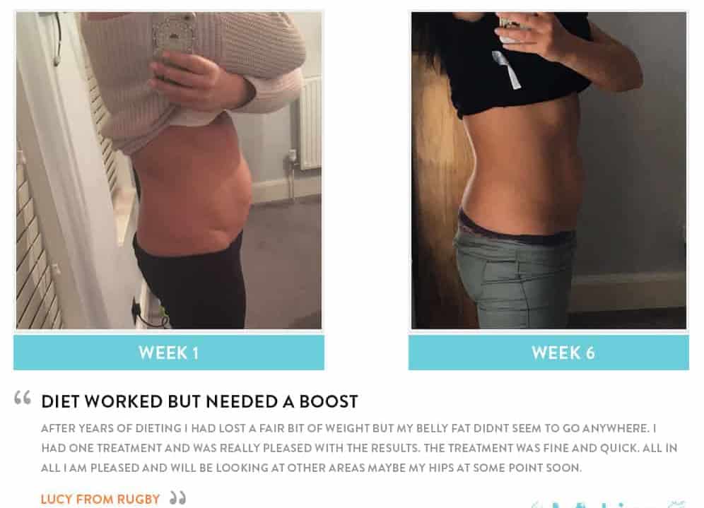 Before and After Dieting Ashford
