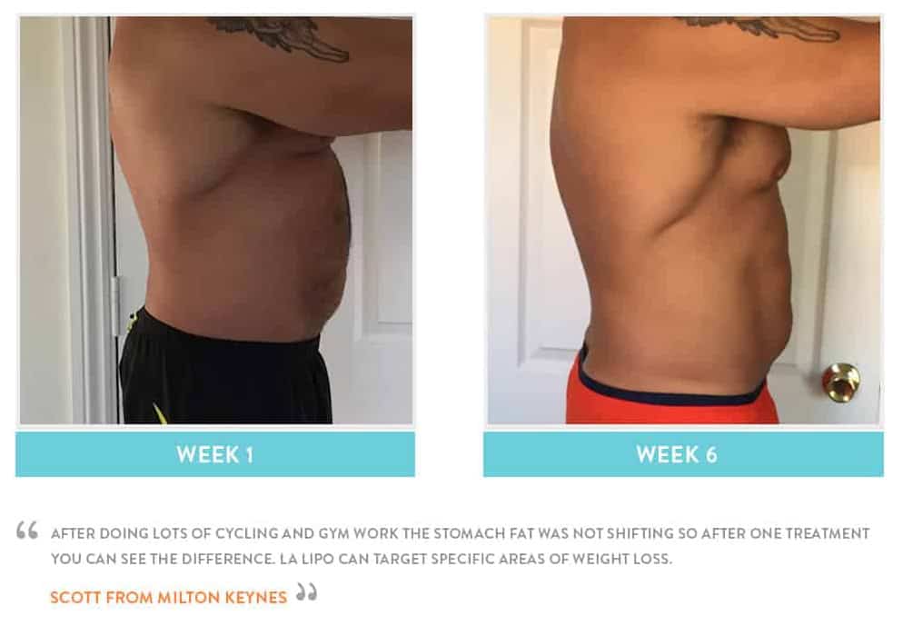 Before & After Stomach Fat Ashford