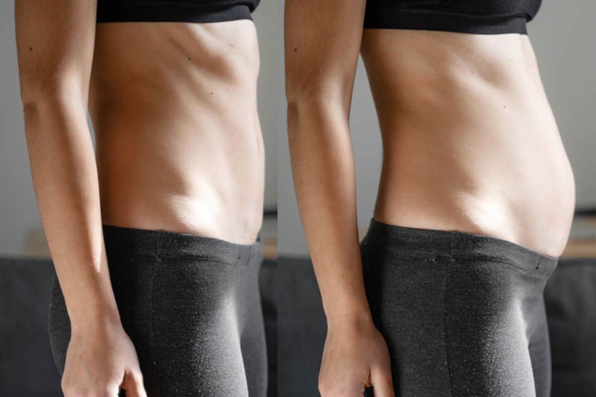How long does diastasis recti take to improve Ashford?