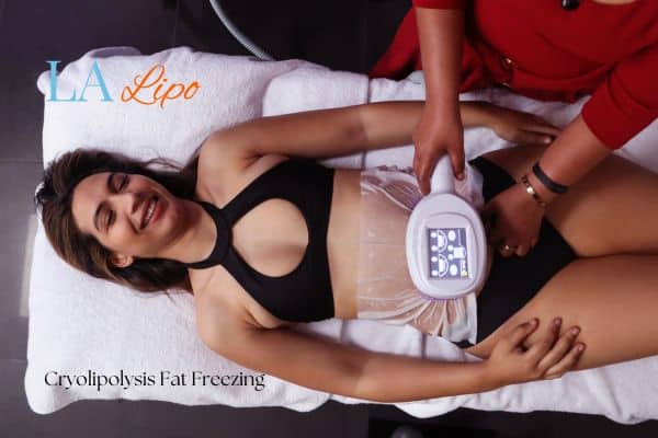 woman getting cryolipolysis Ashford