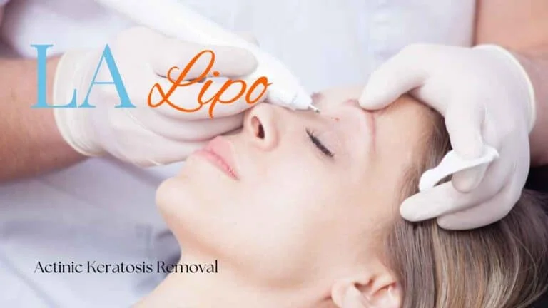 Woman receiving Actinic Keratosis Removal Treatment Ashford