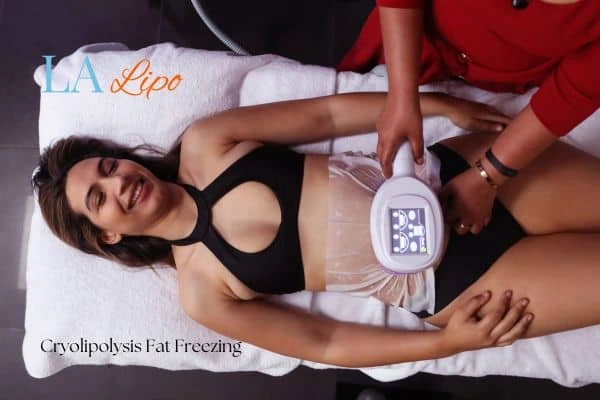 woman getting cryolipolysis Ashford