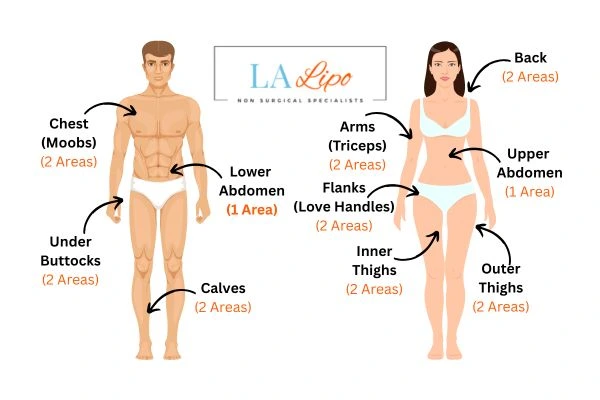 LA LIPO Cryolipolysis Areas Ashford