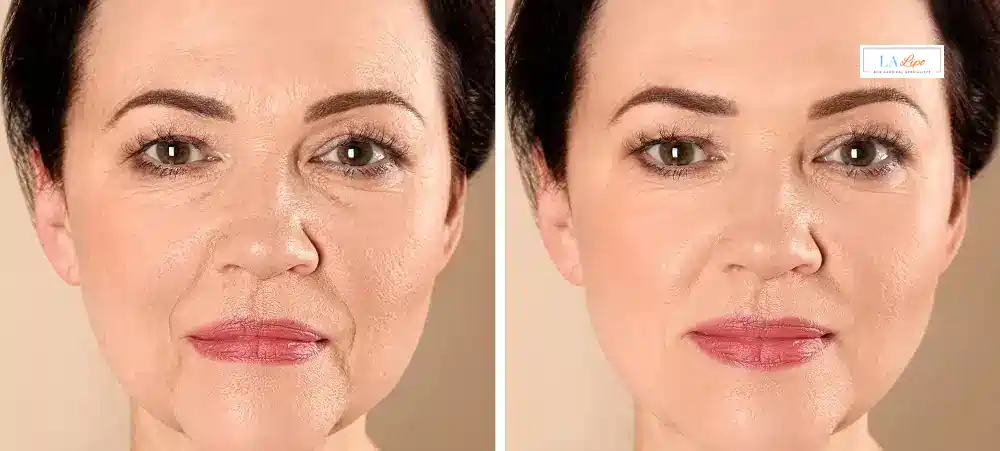 How Long Does It Take to See Results and How Long Do They Last Ashford?