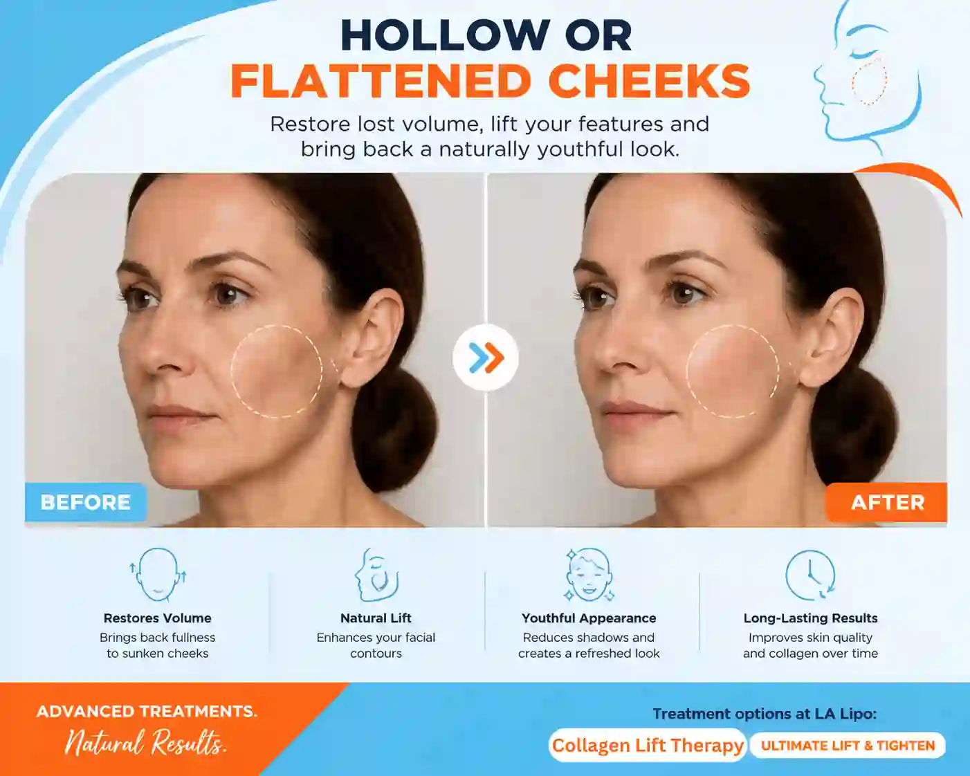 Sign #4: Hollow or Flattened Cheeks Ashford