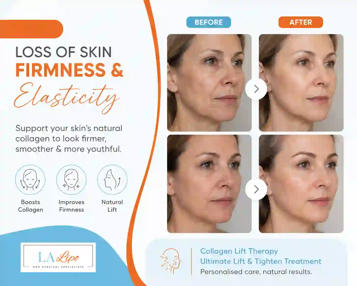 Sign #7: Loss of Skin Firmness and Elasticity Ashford